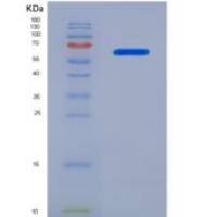 人蛋白激酶Cθ(PKCq)重组蛋白