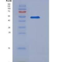 人波形蛋白(VIM)重组蛋白