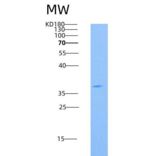 人CD73 / NT5E重组蛋白His tag
