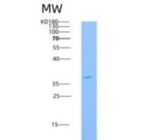 人CD73 / NT5E重组蛋白His tag