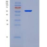 人甲状腺素受体α(THRa)重组蛋白