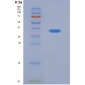 小鼠血管内皮生长因子受体3(VEGFR3)重组蛋白