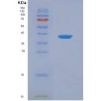 小鼠血管内皮生长因子受体3(VEGFR3)重组蛋白