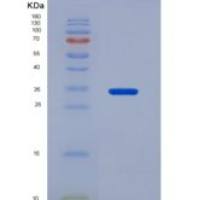 人ATP结合盒转运蛋白G2(ABCG2)重组蛋白