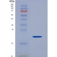 人血小板反应蛋白解整合素金属肽酶5(ADAMTS5)重组蛋白