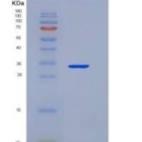 小鼠TNF受体关联因子6(TRAF6)重组蛋白
