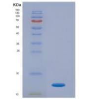 人蛋白聚糖4(PRG4)重组蛋白