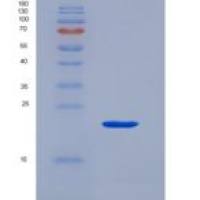 大鼠血管性血友病因子(vWF)重组蛋白