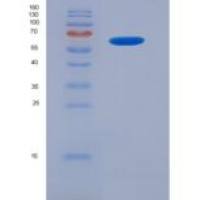 小鼠激肽释放酶6(KLK6)重组蛋白