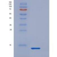 大鼠S100钙结合蛋白A8(S100A8)重组蛋白