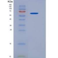 人端粒酶逆转录酶(TERT)重组蛋白