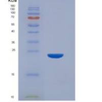 人胱天蛋白酶7(CASP7)重组蛋白