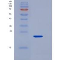 人粘蛋白4(MUC4)重组蛋白