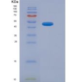 人红细胞衍生核因子2样蛋白2(NFE2L2)重组蛋白