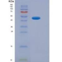 人红细胞衍生核因子2样蛋白2(NFE2L2)重组蛋白