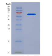 人蛋白激酶Cθ(PKCq)重组蛋白