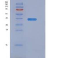 人Syncollin蛋白(SYCN)重组蛋白