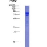 人核有丝分裂器蛋白1(NUMA1)重组蛋白