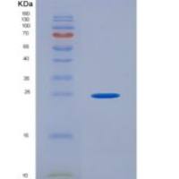 人白介素2受体α(IL2Ra)重组蛋白