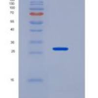 人肿瘤坏死因子受体超家族成员17(TNFRSF17)重组蛋白