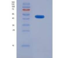 小鼠赖氨酰氧化酶(LOX)重组蛋白