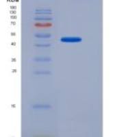 人泛素特异性肽酶7(USP7)重组蛋白