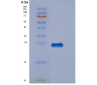 人血栓调节蛋白(TM)重组蛋白