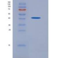 人S-期激酶关联蛋白2(SKP2)重组蛋白