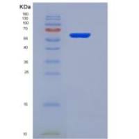 人血小板反应蛋白4(THBS4)重组蛋白