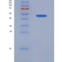 大鼠表面活性物质关联蛋白A(SFTPA1)重组蛋白