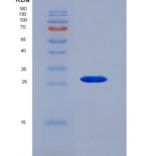 人激肽释放酶4(KLK4)重组蛋白