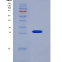人激肽释放酶4(KLK4)重组蛋白