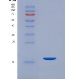 大鼠CD26分子(CD26)重组蛋白