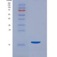 大鼠CD26分子(CD26)重组蛋白