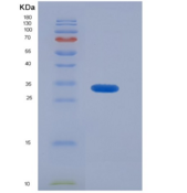 人降钙素(CT)重组蛋白