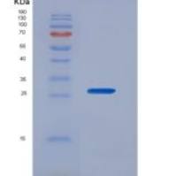 人细胞周期素B(CCNB)重组蛋白