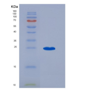 小鼠血小板反应蛋白(THBS1)重组蛋白