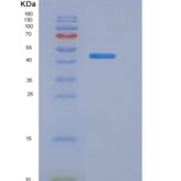 人水通道蛋白4(AQP4)重组蛋白