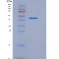 人水通道蛋白4(AQP4)重组蛋白