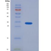 人降钙素(CT)重组蛋白