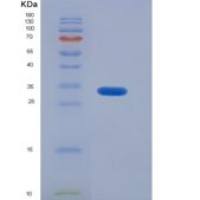 人降钙素(CT)重组蛋白