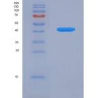 人VGF神经生长因子诱导蛋白(VGF)重组蛋白