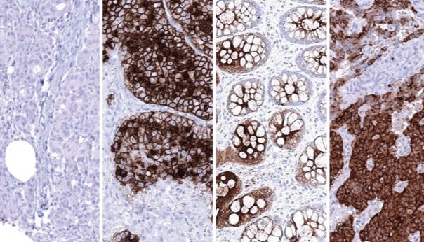 HistoMAX™ – 免疫组化优化抗体