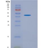 人γ-氨基丁酸B受体1(gABBR1)重组蛋白