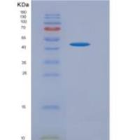 人γ-氨基丁酸B受体1(gABBR1)重组蛋白