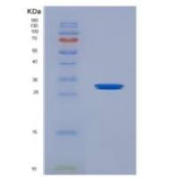 人DNA甲基转移酶1(DNMT1)重组蛋白
