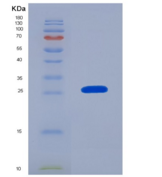 大鼠AGER / RAGE重组蛋白His tag
