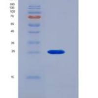小鼠巨噬细胞集落刺激因子受体(MCSFR)重组蛋白