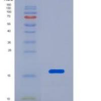 人含Ⅲ型纤连蛋白域蛋白5(FNDC5)重组蛋白