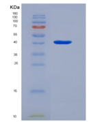 人视紫质(RHO)重组蛋白
